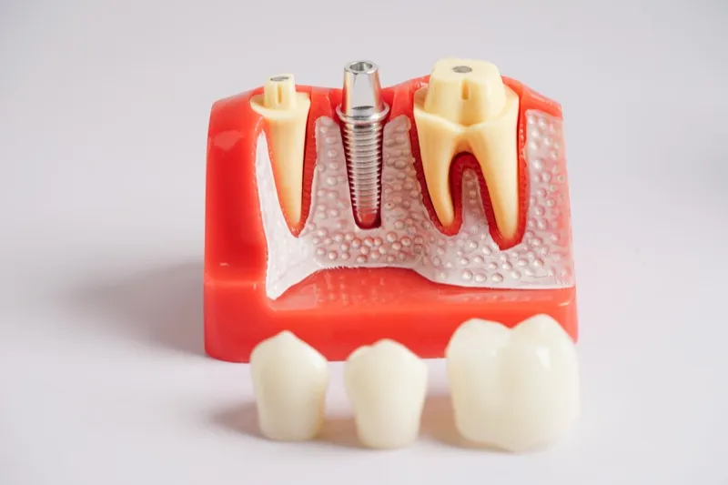 Full-Mouth Implant Restoration in North Haledon, NJ banner